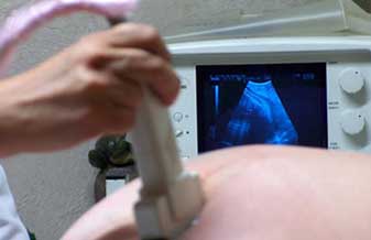 Rita Ney Duarte - Foto 1