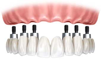 Pedro Carlos Franceschini Filho - Foto 1